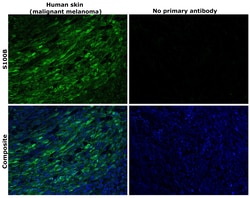 Invitrogen S100B Recombinant Superclonal Antibody (16HCLC) 100 &mu;g; Unconjugated:Antibodies,