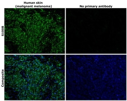 Invitrogen S100B Recombinant Superclonal Antibody (16HCLC) 100 &mu;g; Unconjugated:Antibodies,