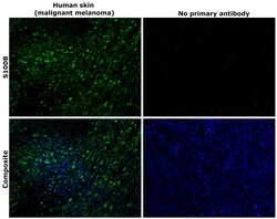 Invitrogen S100B Recombinant Superclonal Antibody (16HCLC) 100 &mu;g; Unconjugated:Antibodies,