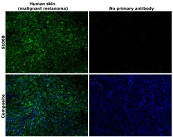 Invitrogen S100B Recombinant Superclonal Antibody (16HCLC) 100 &mu;g; Unconjugated:Antibodies,