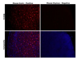 Invitrogen S100B Recombinant Superclonal Antibody (16HCLC) 100 &mu;g; Unconjugated:Antibodies,