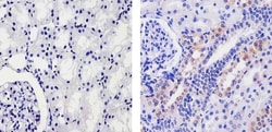 Invitrogen Fibrinogen Recombinant Superclonal Antibody (12 HCLC) 100 &mu;g;