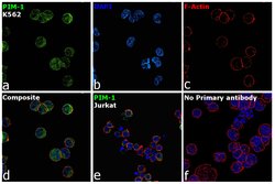 Invitrogen PIM1 Recombinant Superclonal Antibody (19HCLC) 100 &mu;g; Unconjugated:Antibodies,