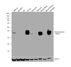 Invitrogen Synaptophysin Recombinant Superclonal Antibody (8HCLC) 100 &mu;g;