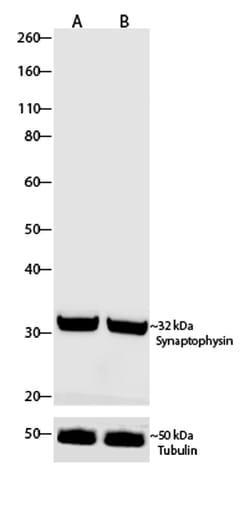 Invitrogen Synaptophysin Recombinant Superclonal Antibody (8HCLC) 100 &mu;g;