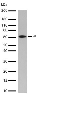 Invitrogen SQSTM1 Recombinant Superclonal Antibody (11HCLC) 100 &mu;g;