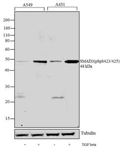Phospho-SMAD3 (Ser423, Ser425) Recombinant Polyclonal Antibody (12HCLC),