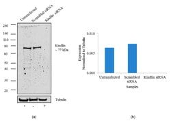 Invitrogen Kindlin Recombinant Superclonal Antibody 100 &mu;g | Buy Online | Invitrogen&trade; | Fisher Scientific