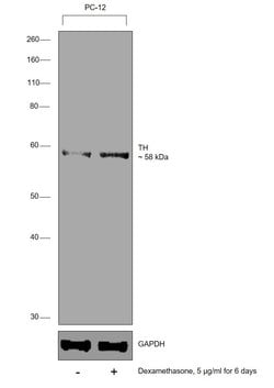 Invitrogen Tyrosine Hydroxylase Recombinant Superclonal Antibody (9HCLC)