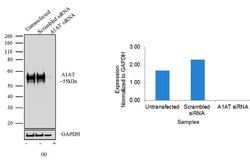 Invitrogen alpha-1 Antitrypsin Recombinant Superclonal Antibody 100 &mu;g;