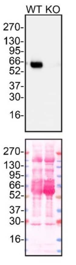 Invitrogen alpha-1 Antitrypsin Recombinant Superclonal Antibody 100 &mu;g | Buy Online | Invitrogen&trade; | Fisher Scientific