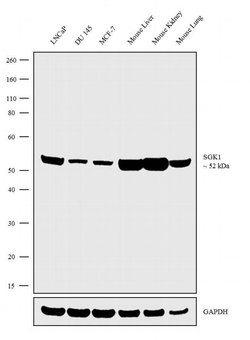Invitrogen&trade;&nbsp;SGK1 Recombinant Superclonal&trade; Antibody (22HCLC)