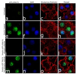 Phospho-ATF2 (Tyr69, Thr71) Recombinant Polyclonal Antibody (24HCLC), Invitrogen