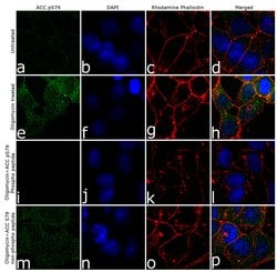 Phospho-Acetyl-CoA Carboxylase (Ser79) Recombinant Polyclonal Antibody