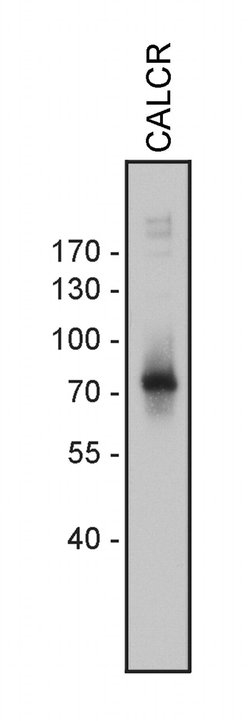 Invitrogen Calcitonin Receptor Recombinant Superclonal Antibody (1HCLC)