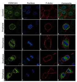 Invitrogen CK1 alpha Recombinant Superclonal Antibody (5HCLC) 100 &mu;g;