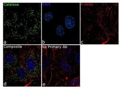 Invitrogen Catalase Recombinant Superclonal Antibody (10HCLC) 100 &mu;g;