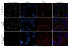 Invitrogen Citrate Synthase Recombinant Superclonal Antibody (5HCLC) 100