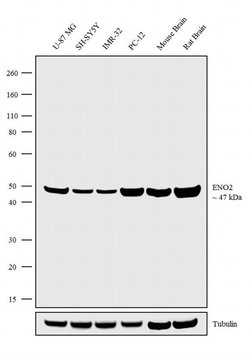 Invitrogen NSE Recombinant Superclonal Antibody (10HCLC) 100 &mu;g; Unconjugated:Antibodies,