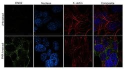 Invitrogen NSE Recombinant Superclonal Antibody (10HCLC) 100 &mu;g; Unconjugated:Antibodies,