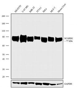 Invitrogen&trade;&nbsp;LIMP2 Recombinant Superclonal&trade; Antibody (12HCLC)
