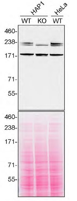 Invitrogen SPG11 Recombinant Superclonal Antibody (2HCLC) 100 &mu;g; Unconjugated:Antibodies,
