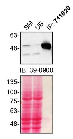 Invitrogen Parkin Recombinant Superclonal Antibody (21HCLC) 100 &mu;g;