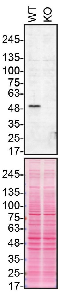 Invitrogen Parkin Recombinant Superclonal Antibody (21HCLC) 100 &mu;g;
