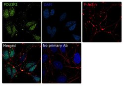 Invitrogen&trade;&nbsp;POU3F2 Recombinant Superclonal&trade; Antibody (24HCLC)