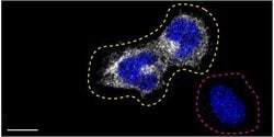 Invitrogen Optineurin Recombinant Superclonal Antibody 100 &mu;g; Unconjugated:Antibodies,