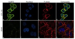 Invitrogen ULBP3 Recombinant Superclonal Antibody (11HCLC) 100 &mu;g; Unconjugated:Antibodies,