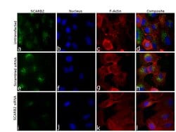 Invitrogen LIMP2 Recombinant Superclonal Antibody 100 &mu;g | Buy Online | Invitrogen&trade; | Fisher Scientific