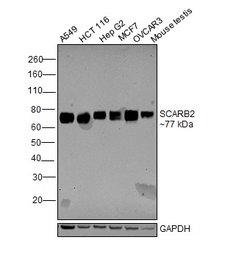 Invitrogen LIMP2 Recombinant Superclonal Antibody 100 &mu;g | Buy Online | Invitrogen&trade; | Fisher Scientific