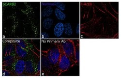 Invitrogen LIMP2 Recombinant Superclonal Antibody 100 &mu;g | Buy Online | Invitrogen&trade; | Fisher Scientific