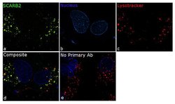Invitrogen LIMP2 Recombinant Superclonal Antibody 100 &mu;g | Buy Online | Invitrogen&trade; | Fisher Scientific