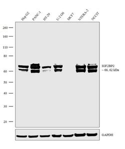 Invitrogen IGF2BP2 Recombinant Superclonal Antibody (1HCLC) 100 &mu;g;