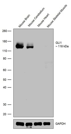 CD138 (Syndecan-1) Monoclonal Antibody (MI15), PE-eFluor 610, eBioscience