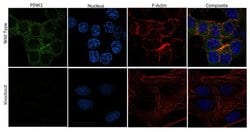 Invitrogen PINK1 Recombinant Superclonal Antibody (15HCLC) 100 &mu;g; Unconjugated:Antibodies,