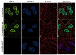 Invitrogen PRMT5 Recombinant Superclonal Antibody (3HCLC) 100 &mu;g; Unconjugated:Antibodies,