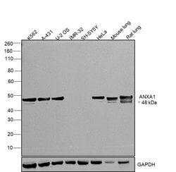 Invitrogen Annexin A1 Polyclonal Antibody 100 &mu;L; Unconjugated:Antibodies,