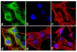 Invitrogen Huntingtin Polyclonal Antibody 100 &mu;g | Buy Online | Invitrogen&trade; | Fisher Scientific