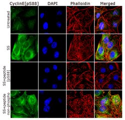 Phospho-Cyclin E (Ser88) Polyclonal Antibody, Invitrogen 100 &mu;g; Unconjugated:Antibodies,