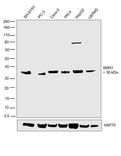 Invitrogen SMN1 Polyclonal Antibody 100 &mu;g; Unconjugated:Antibodies,