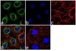 Invitrogen AGR2 Polyclonal Antibody 100 &mu;g; Unconjugated:Antibodies,