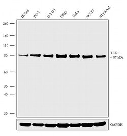 Invitrogen TLK1 Polyclonal Antibody 100 &mu;g | Buy Online | Invitrogen&trade; | Fisher Scientific