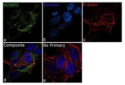 Invitrogen KChIP2 Polyclonal Antibody 100 &mu;g; Unconjugated:Antibodies,