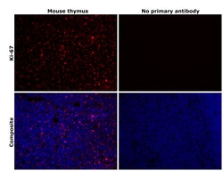 Invitrogen Ki-67 Recombinant Rat Monoclonal Antibody (SolA15), Invitrogen
