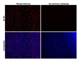 Invitrogen Ki-67 Recombinant Rat Monoclonal Antibody (SolA15), Invitrogen