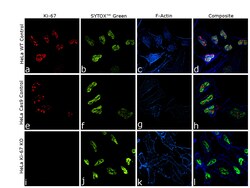 Ki-67 Recombinant Rat Monoclonal Antibody (SolA15), Invitrogen:Antibodies:Primary