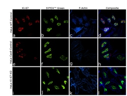 Invitrogen Ki-67 Recombinant Rat Monoclonal Antibody (SolA15), Invitrogen